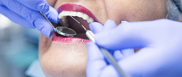 Best Emergency Treatment for Dental Infections or Abscesses in Sky Valley, CA